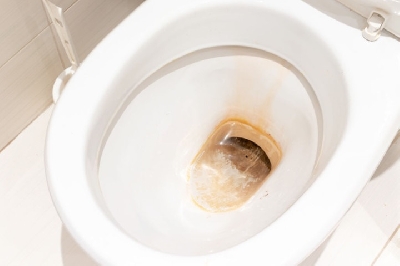 Hóa chất tẩy rửa vệ sinh công nghiệp làm sạch bồn vệ sinh dễ dàng - iến bạn ghê sợ và đã đã sử dụng nhiều cách tẩy bồn cầu mà không được hài lòng?

Yên tâm đã có chúng tôi sẽ giúp bạn cách vệ sinh tẩy bồn cầu, tẩy sạch sẽ các vết bẩn ố vàng hiệu 